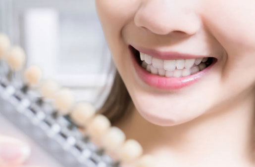 teeth whitening tarpon springs fl