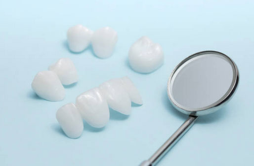 Dental Veneers in Tarpon Springs, FL - Tarpon Dental