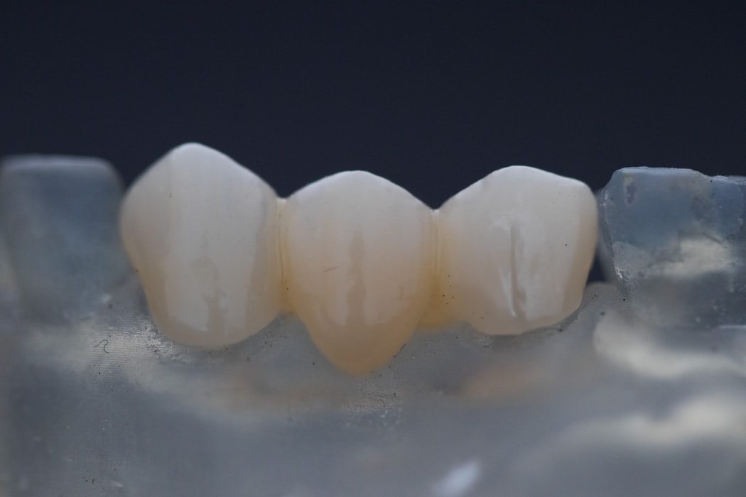 dental tarpon springs fl