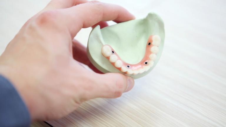 cosmetic dentist tarpon springs