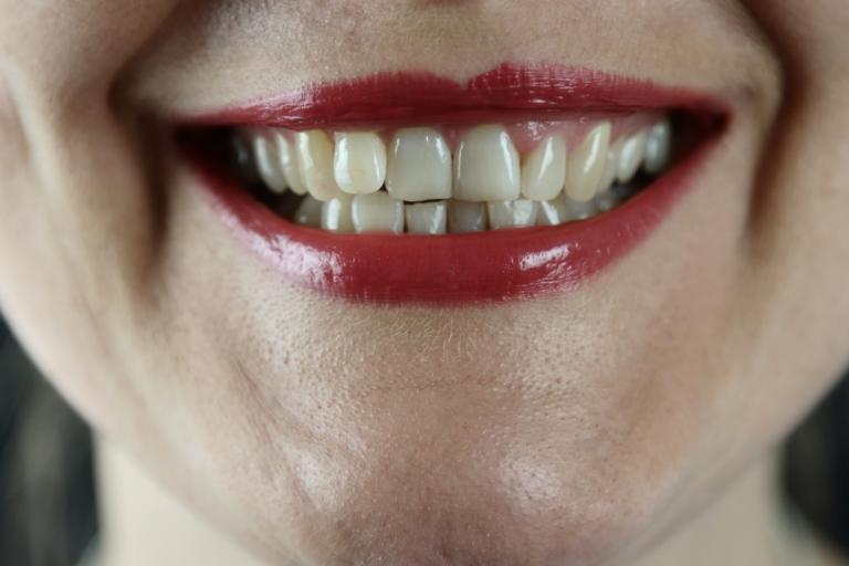 dental emergency dentist palm harbor