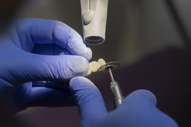 dental fillings services tarpon springs