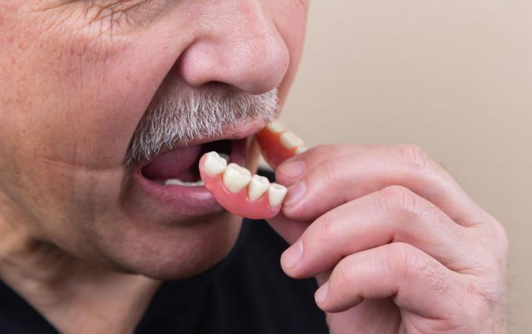 dental implant vs dentures procedure
