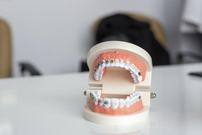 invisalign emergency dentist in palm harbor florida