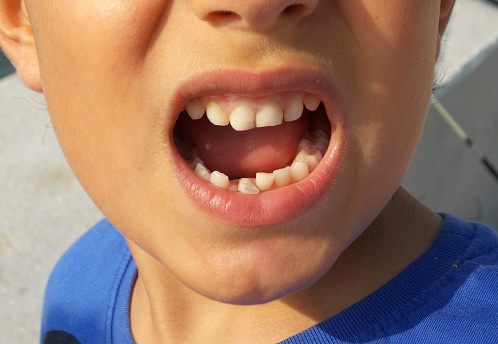 best emergency dentist in tarpon springs