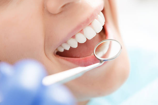 bone grafting treatment in tarpon springs