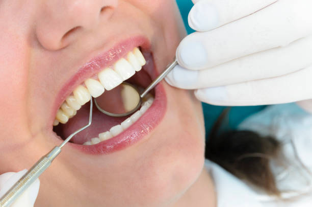 best cosmetic dentist in tarpon springs fl