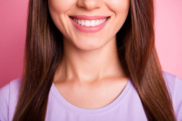 a woman having dental veneers treatment
