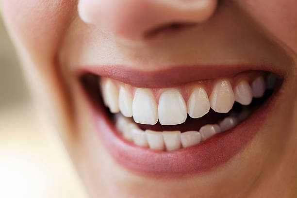 best teeth whitening services