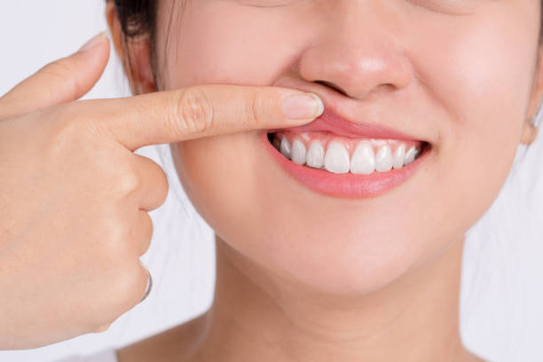 best gum therapy tarpon springs fl
