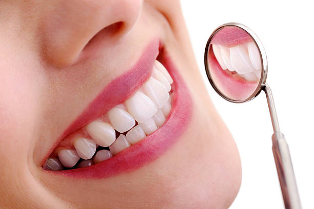teeth whitening
